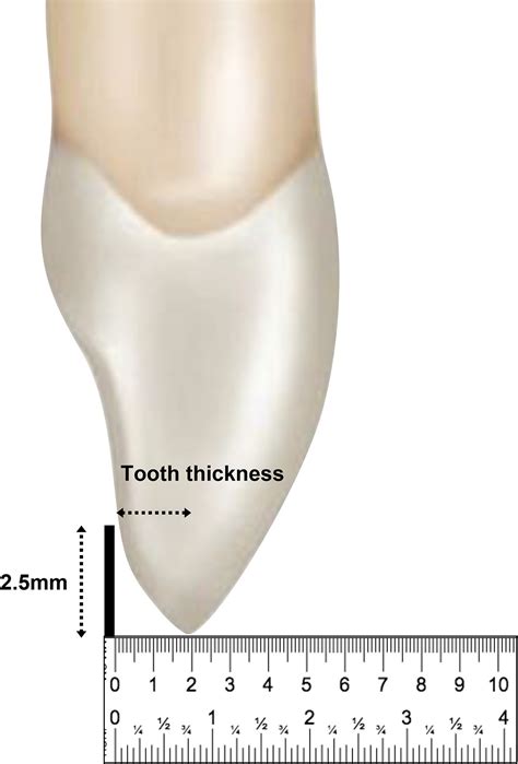 how to measure tooth thickness